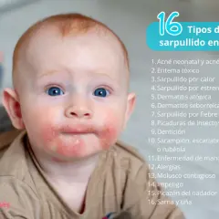 Bebé con sarpullidos en la piel alrededor de la boca y mejillas. La imagen lista 16 tipos de sarpullidos en bebés.