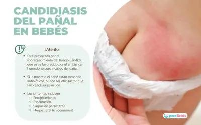 Bebé con enrojecimiento e irritación en la zona del pañal, indicativo de candidiasis del pañal.