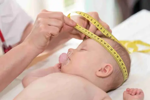 Un bebé duerme con un chupete mientras le miden la cabeza con una cinta métrica, asegurando el seguimiento de las normal formas de cabeza de bebes.