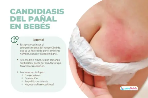 Bebé con enrojecimiento e irritación en la zona del pañal, indicativo de candidiasis del pañal.