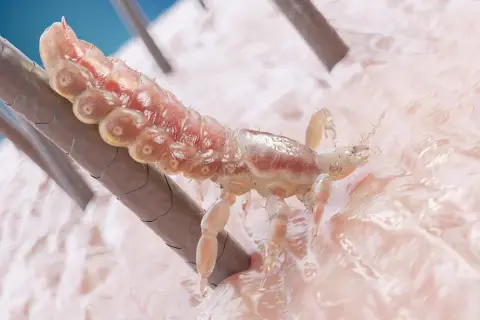 Un piojo se aferra a un cabello, mostrando su cuerpo segmentado y patas. Se aprecian detalles de su anatomía, sugiriendo la presencia de liendres.