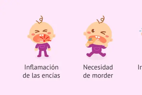 Ilustraciones de bebés que muestran síntomas cuando empiezan a salir los dientes: babeo, encías inflamadas, necesidad de morder y llanto.