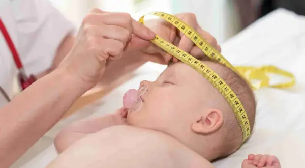 Un bebé duerme con un chupete mientras le miden la cabeza con una cinta métrica, asegurando el seguimiento de las normal formas de cabeza de bebes.