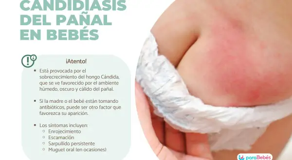 Bebé con enrojecimiento e irritación en la zona del pañal, indicativo de candidiasis del pañal.