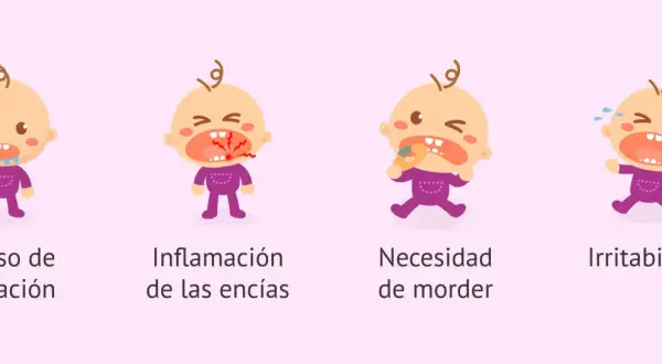 Ilustraciones de bebés que muestran síntomas cuando empiezan a salir los dientes: babeo, encías inflamadas, necesidad de morder y llanto.