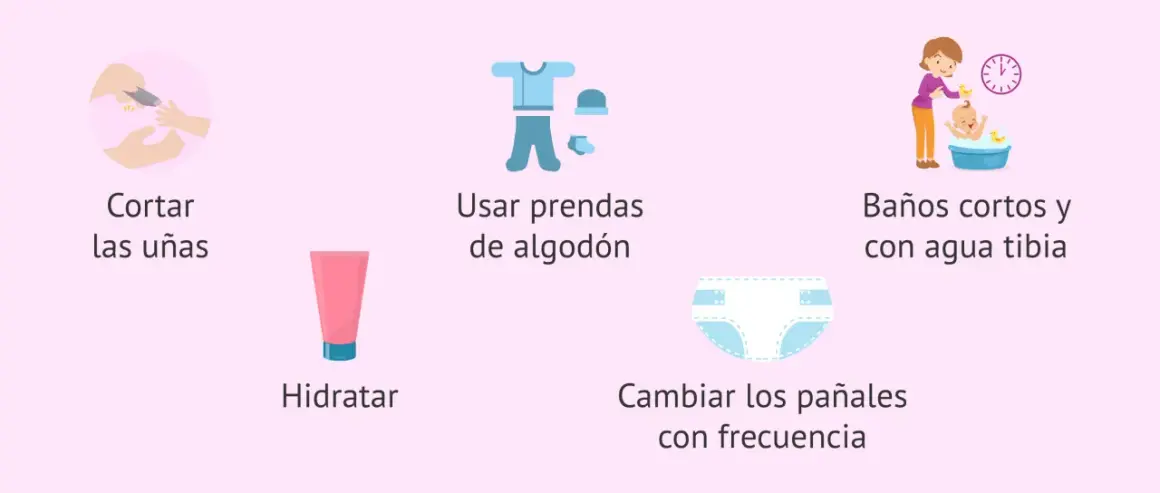 Consejos para el cuidado de la piel del bebé: cortar uñas, hidratar, ropa de algodón, baños tibios y cambiar pañales. Ayuda a prevenir el eccema bebe.