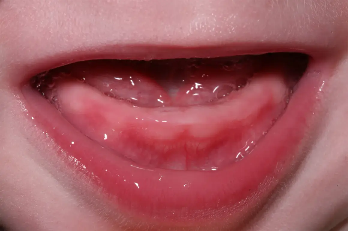 Encías rosadas y húmedas, con burbujas, listas para los primeros dientes bebé 4 meses.