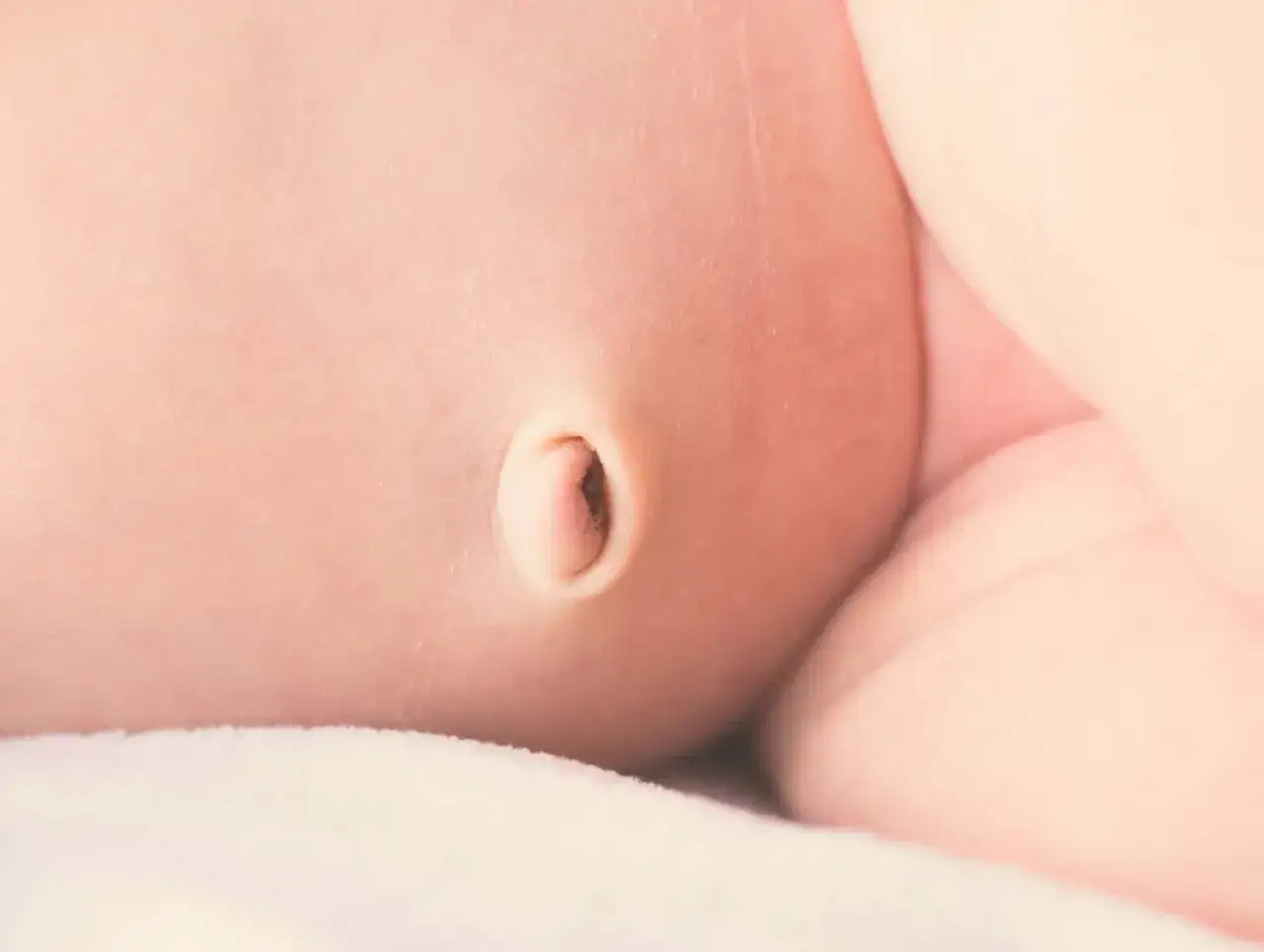 Primer plano del abdomen de un bebé, mostrando un ombligo que podría ser indicativo de una hernia umbilical en niños.