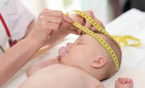 Un bebé duerme con un chupete mientras le miden la cabeza con una cinta métrica, asegurando el seguimiento de las normal formas de cabeza de bebes.