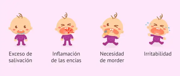 Ilustraciones de bebés que muestran síntomas cuando empiezan a salir los dientes: babeo, encías inflamadas, necesidad de morder y llanto.